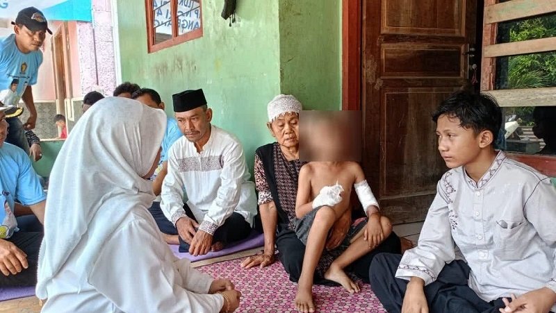 Kisah Pilu Bocah Korban Kecelakaan Truk Tanah Saat Dijenguk Tim Maesyal-Intan dan Andra-Dimyati