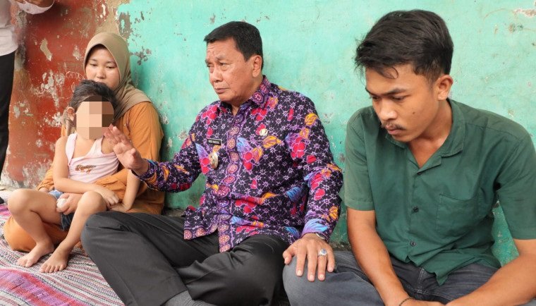 Bupati Tangerang Kunjungi Anak Penderita Kanker Mata di Kronjo